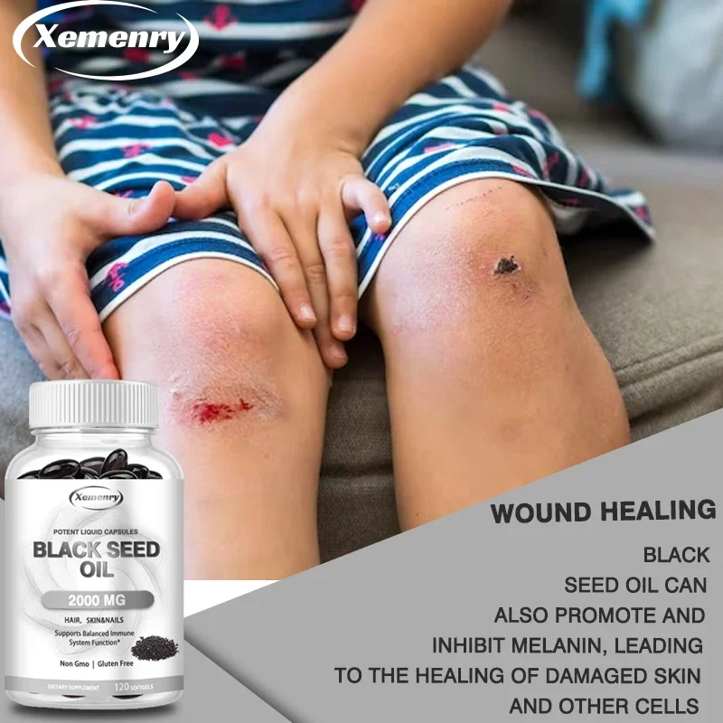 كبسولات زيت البذور السوداء الن - مراجعة Black Seed Oil Capsule وسعره